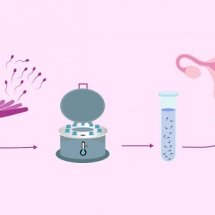 Donar Sperm